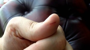 Judy Larson's Using Household Super Glue on Minor Cuts, Nicks and Scrapes - , Tools For Wire Jewelry, Tools, , safety, Cracked skin from wire working