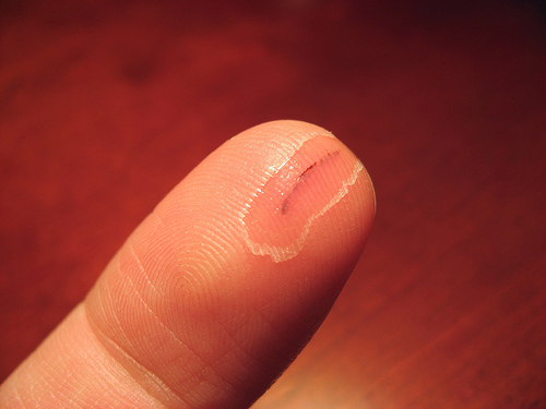 Judy Larson's Using Household Super Glue on Minor Cuts, Nicks and Scrapes - , Tools For Wire Jewelry, Tools, , safety, Cracked skin from wire working